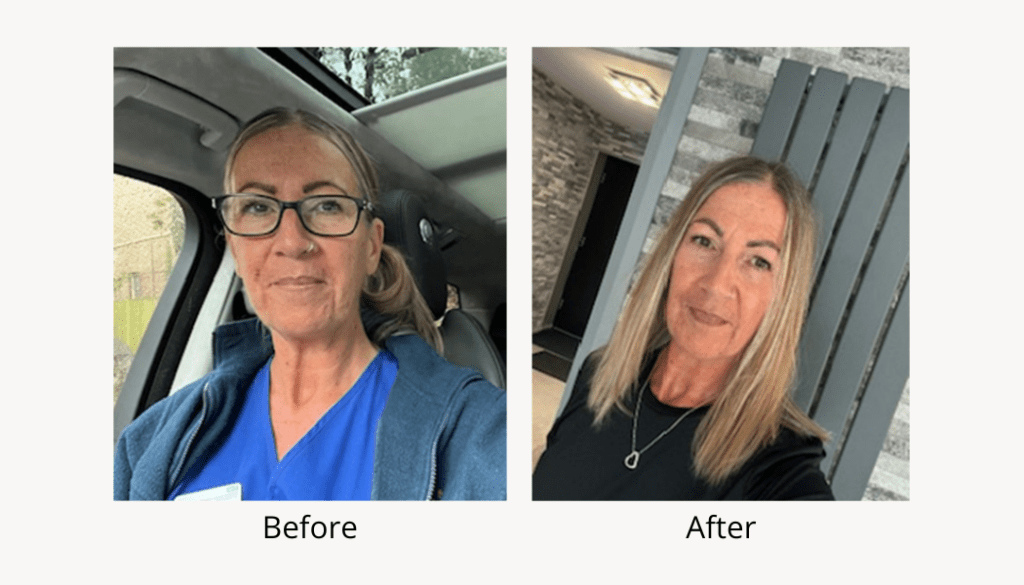 Centre for Sight Sue H Before and After V2